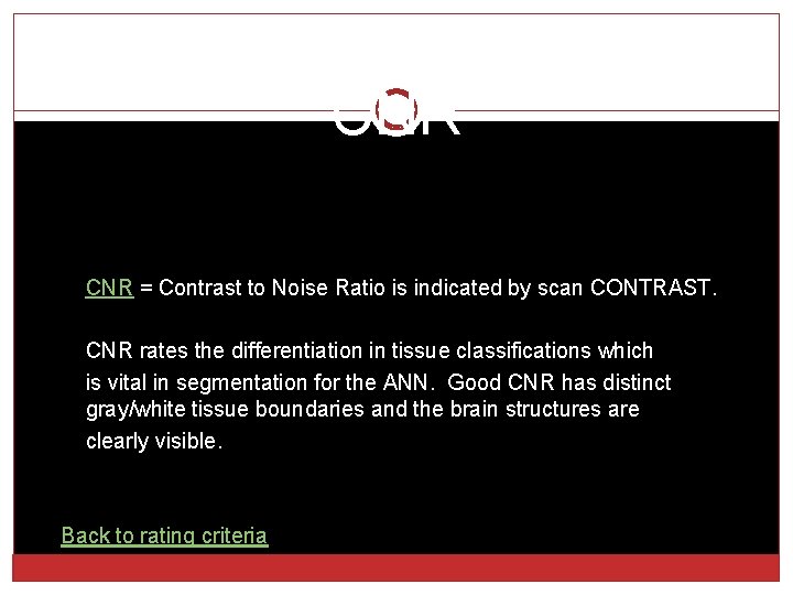 CNR = Contrast to Noise Ratio is indicated by scan CONTRAST. CNR rates the