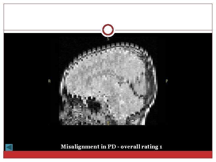 Misalignment in PD - overall rating 1 