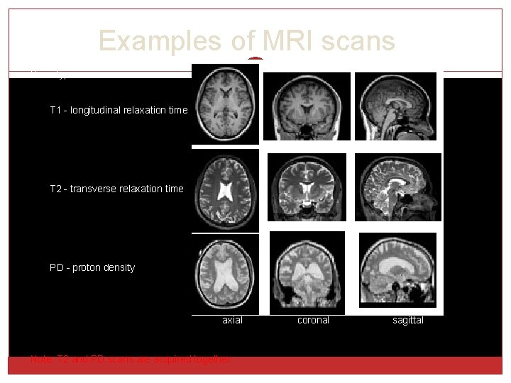 Examples of MRI scans Scan types: T 1 - longitudinal relaxation time T 2