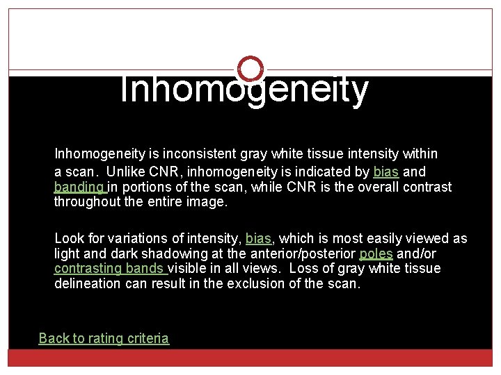 Inhomogeneity is inconsistent gray white tissue intensity within a scan. Unlike CNR, inhomogeneity is