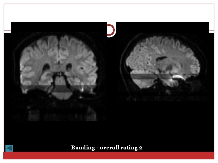 Banding - overall rating 2 