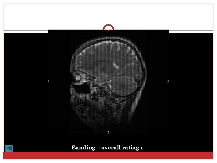 Banding - overall rating 1 