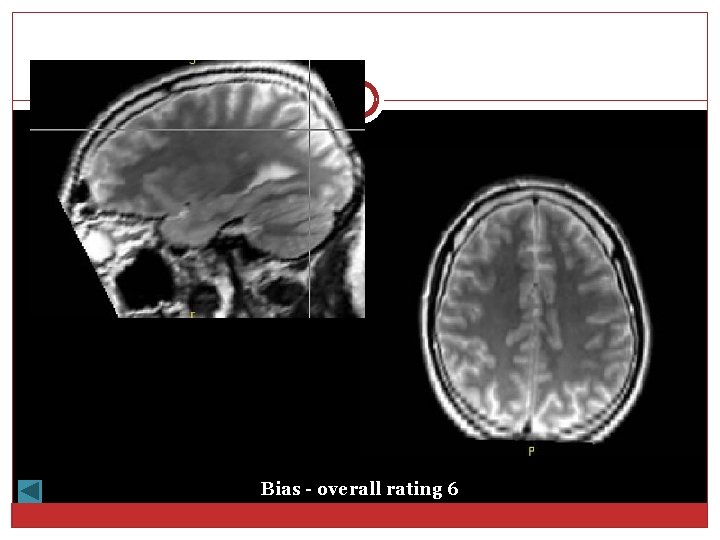 Bias - overall rating 6 