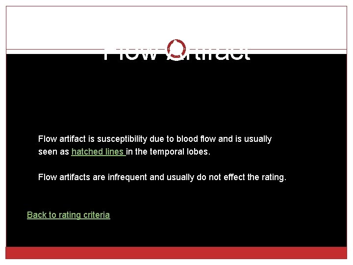 Flow Artifact Flow artifact is susceptibility due to blood flow and is usually seen