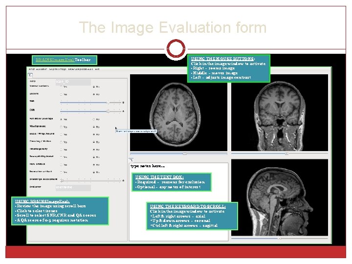 The Image Evaluation form USING THE MOUSE BUTTONS: Click in the image window to