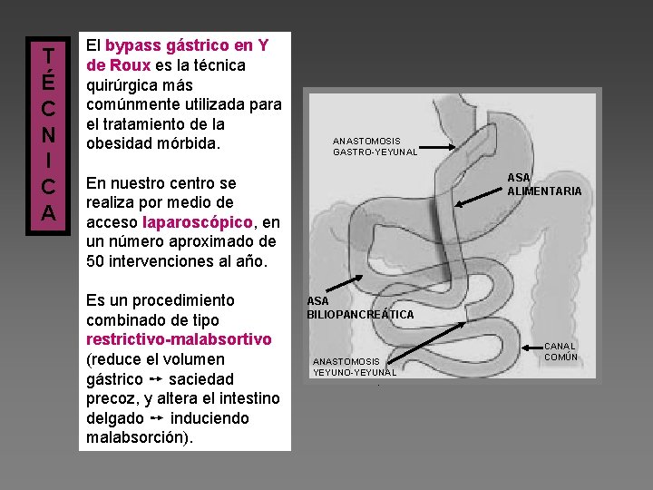 T É C N I C A El bypass gástrico en Y de Roux