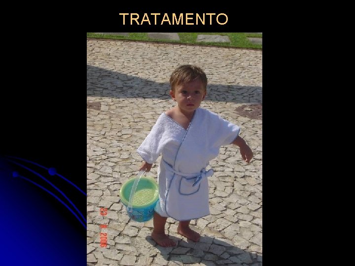 TRATAMENTO 