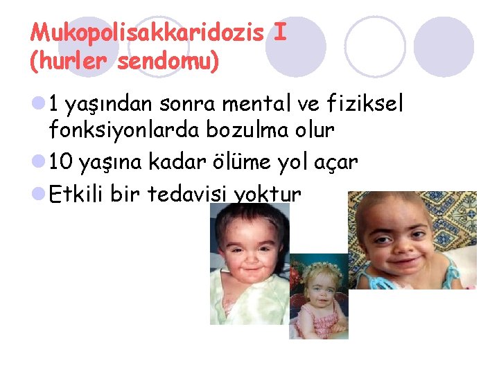 Mukopolisakkaridozis I (hurler sendomu) l 1 yaşından sonra mental ve fiziksel fonksiyonlarda bozulma olur
