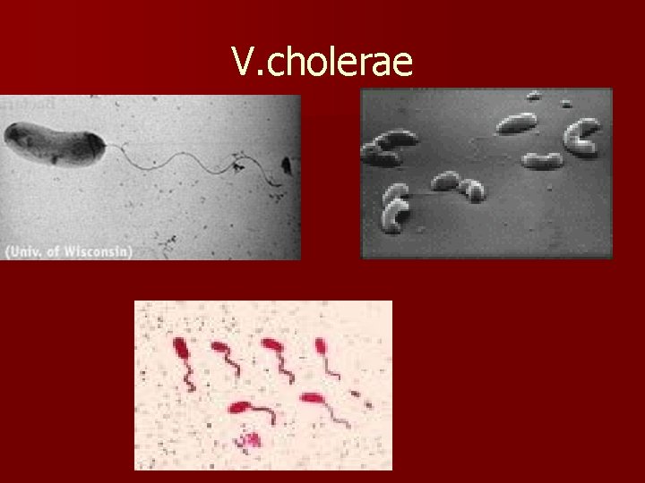 V. cholerae 