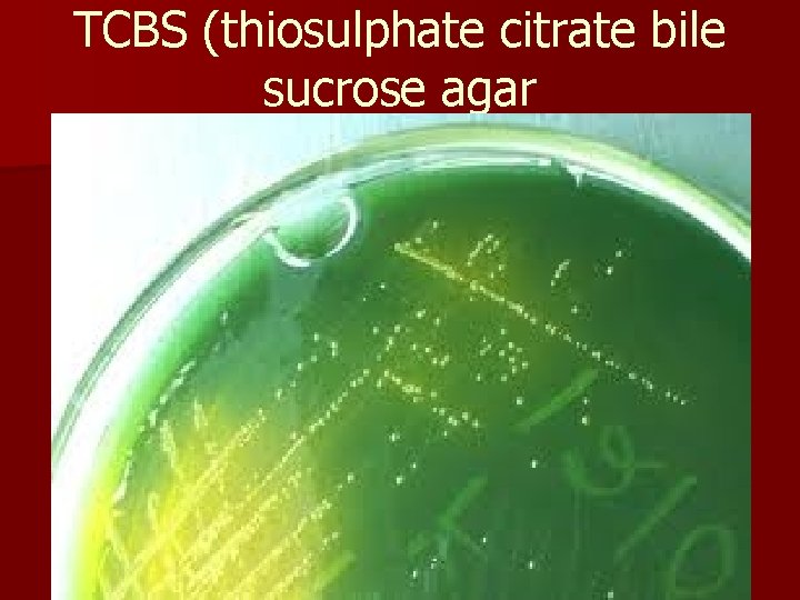 TCBS (thiosulphate citrate bile sucrose agar 