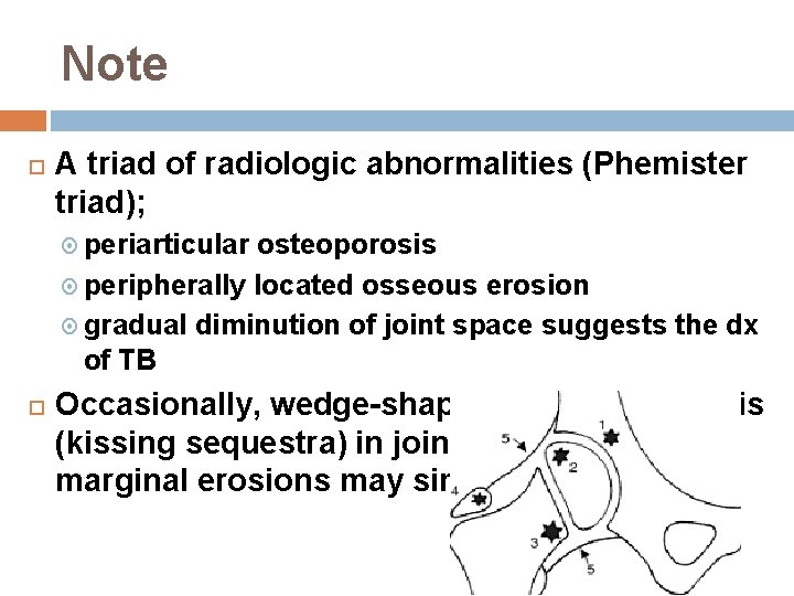 Note A triad of radiologic abnormalities (Phemister triad); periarticular osteoporosis peripherally located osseous erosion