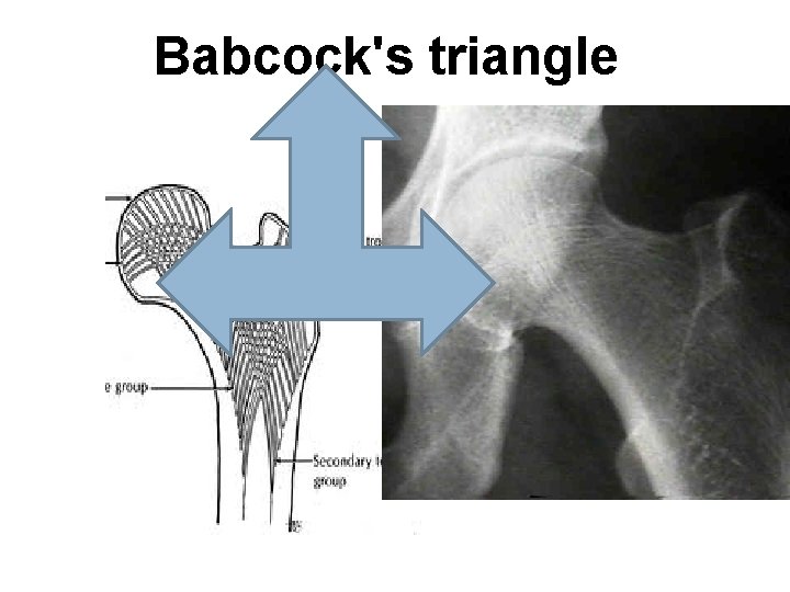 Babcock's triangle 