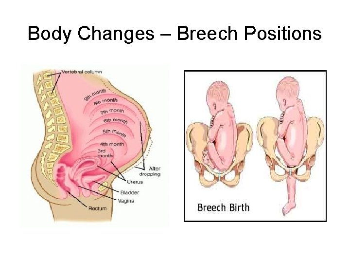 Body Changes – Breech Positions 