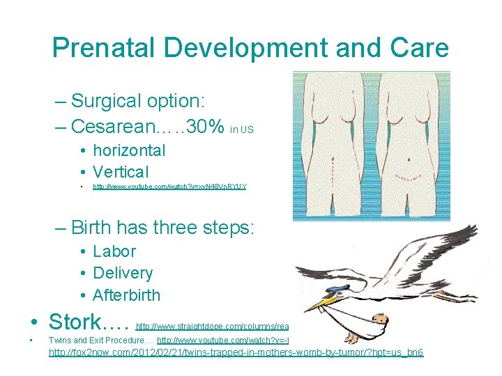 Prenatal Development and Care – Surgical option: – Cesarean…. . 30% in US •