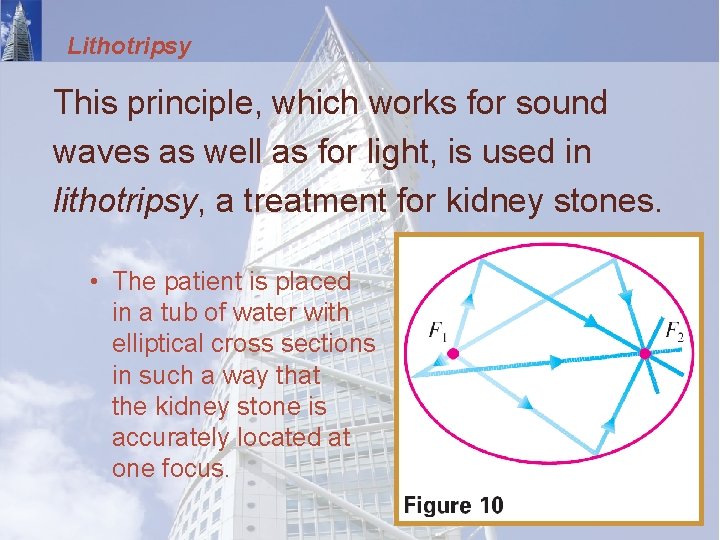 Lithotripsy This principle, which works for sound waves as well as for light, is
