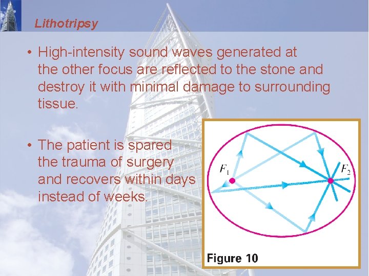 Lithotripsy • High-intensity sound waves generated at the other focus are reflected to the