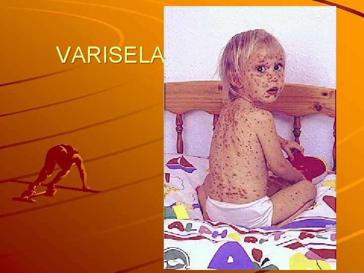 VARISELA 