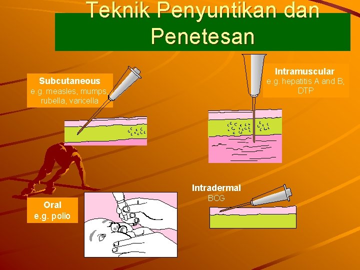 Teknik Penyuntikan dan Penetesan Intramuscular Subcutaneous e. g. hepatitis A and B, DTP e.
