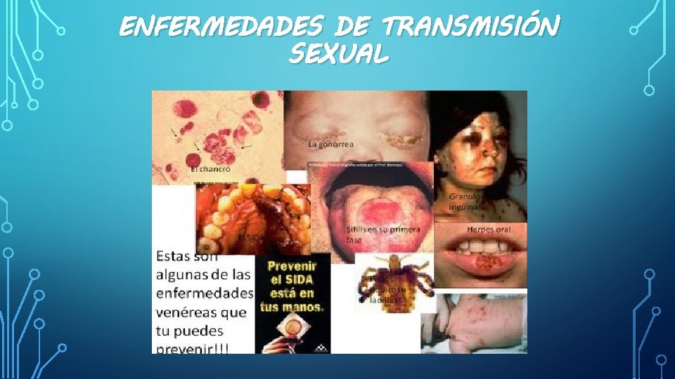 ENFERMEDADES DE TRANSMISIÓN SEXUAL 