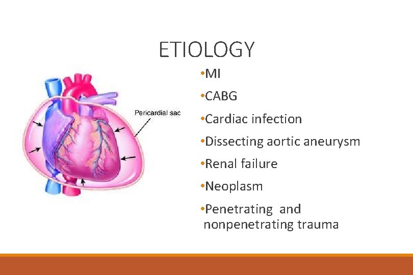 ETIOLOGY • MI • CABG • Cardiac infection • Dissecting aortic aneurysm • Renal