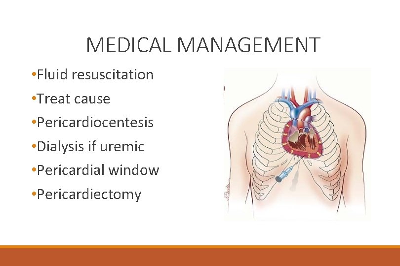 MEDICAL MANAGEMENT • Fluid resuscitation • Treat cause • Pericardiocentesis • Dialysis if uremic