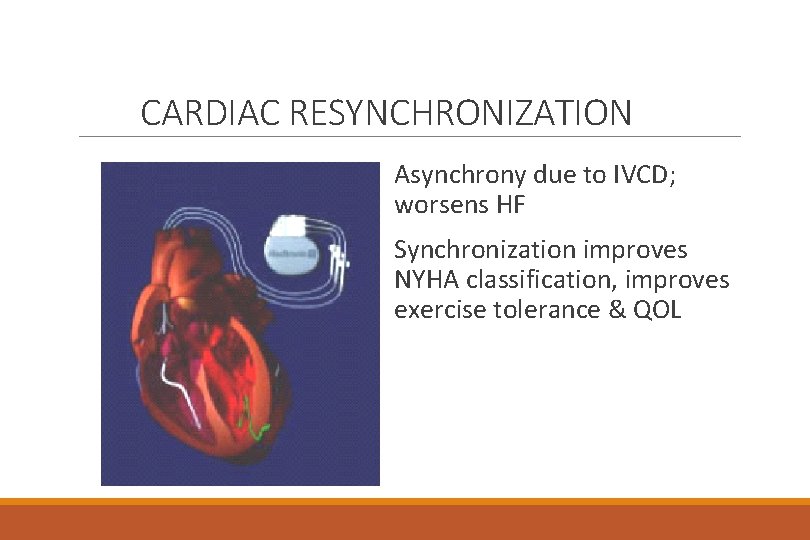 CARDIAC RESYNCHRONIZATION Asynchrony due to IVCD; worsens HF Synchronization improves NYHA classification, improves exercise