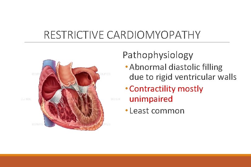 RESTRICTIVE CARDIOMYOPATHY Pathophysiology • Abnormal diastolic filling due to rigid ventricular walls • Contractility