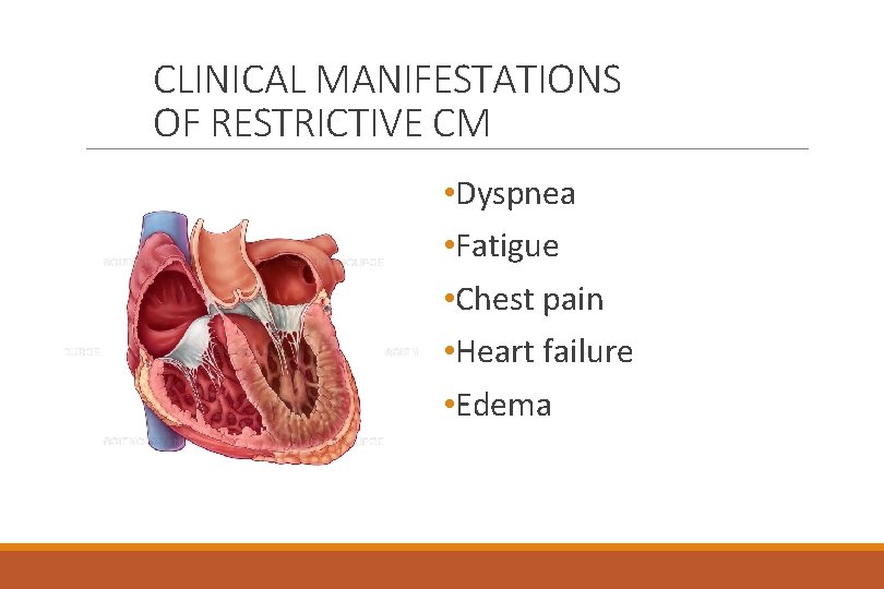 CLINICAL MANIFESTATIONS OF RESTRICTIVE CM • Dyspnea • Fatigue • Chest pain • Heart