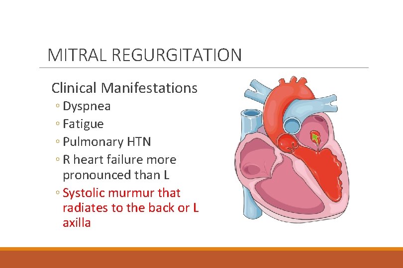 MITRAL REGURGITATION Clinical Manifestations ◦ Dyspnea ◦ Fatigue ◦ Pulmonary HTN ◦ R heart