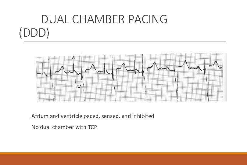 DUAL CHAMBER PACING (DDD) Atrium and ventricle paced, sensed, and inhibited No dual chamber