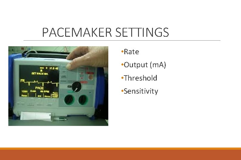 PACEMAKER SETTINGS • Rate • Output (m. A) • Threshold • Sensitivity 