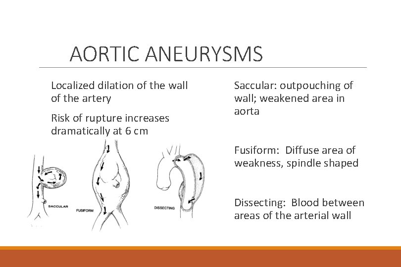 AORTIC ANEURYSMS Localized dilation of the wall of the artery Risk of rupture increases