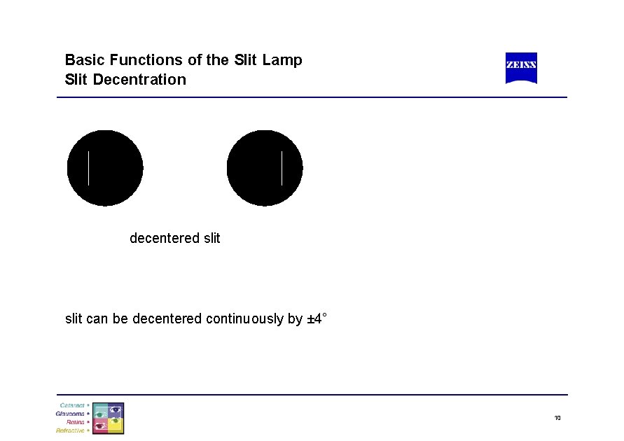 Basic Functions of the Slit Lamp Slit Decentration decentered slit can be decentered continuously