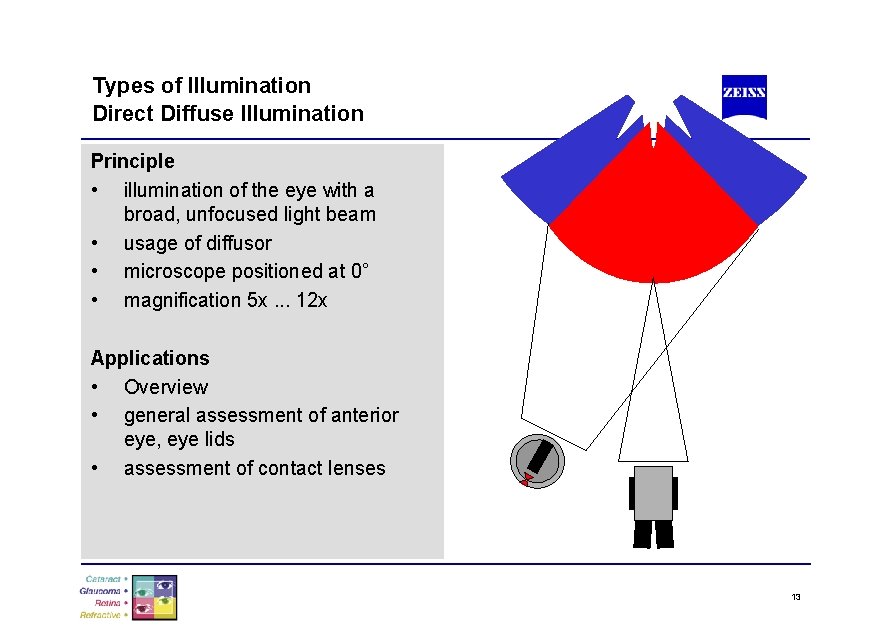 Types of Illumination Direct Diffuse Illumination Principle • illumination of the eye with a