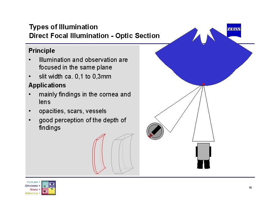 Types of Illumination Direct Focal Illumination - Optic Section Principle • Illumination and observation