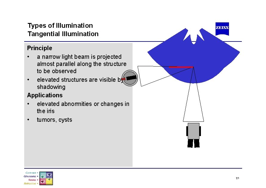 Types of Illumination Tangential Illumination Principle • a narrow light beam is projected almost
