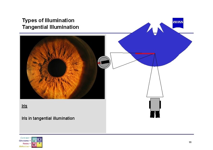 Types of Illumination Tangential Illumination Iris in tangential illumination 22 