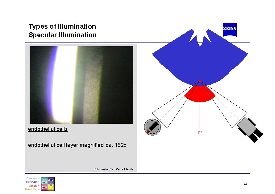 Types of Illumination Specular Illumination α endothelial cells α 0° endothelial cell layer magnified