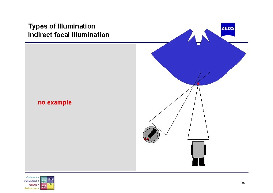 Types of Illumination Indirect focal Illumination no example 28 
