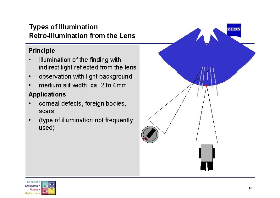 Types of Illumination Retro-Illumination from the Lens Principle • Illumination of the finding with