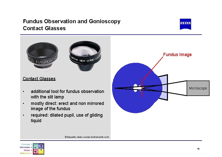 Fundus Observation and Gonioscopy Contact Glasses Fundus Image Contact Glasses • • • additional