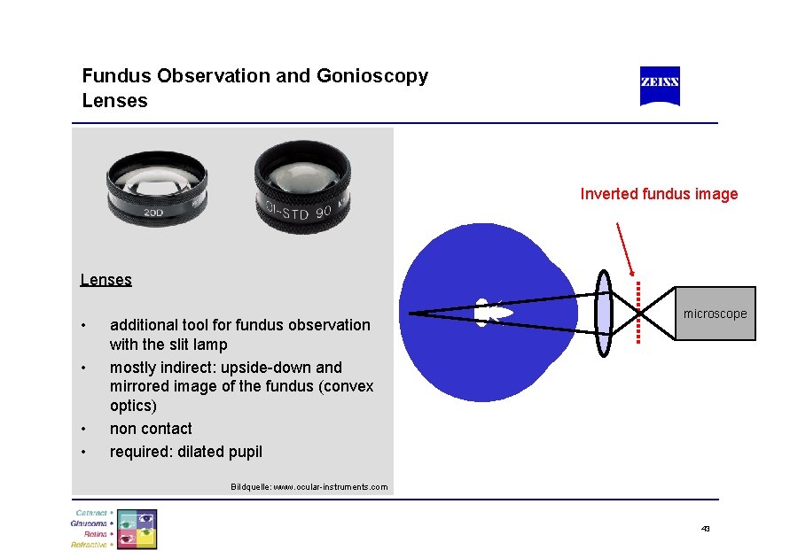 Fundus Observation and Gonioscopy Lenses Inverted fundus image Lenses • • additional tool for