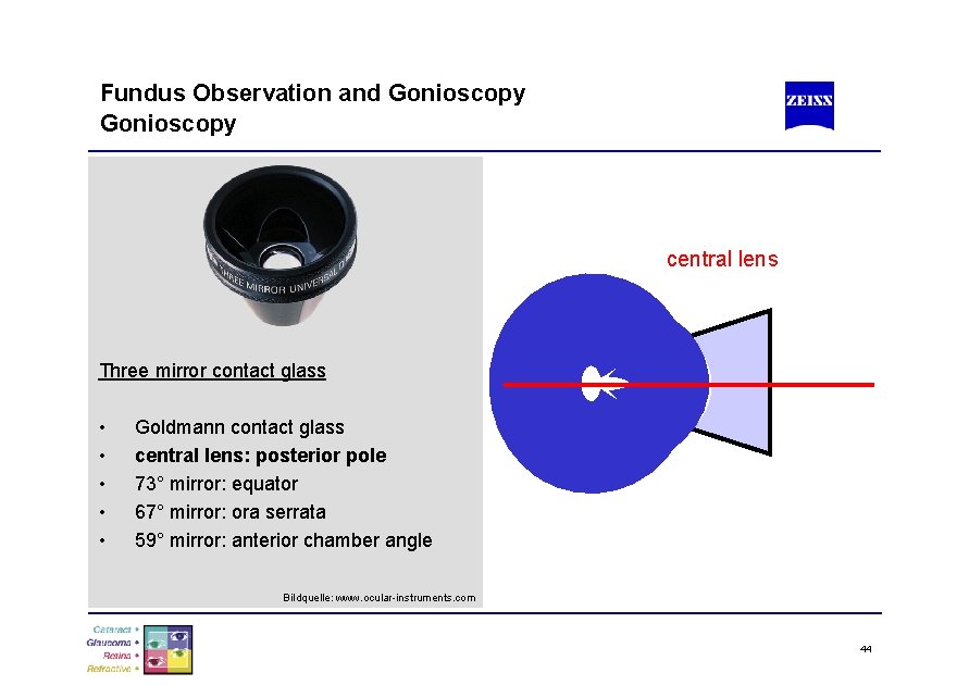 Fundus Observation and Gonioscopy central lens Three mirror contact glass • • • Goldmann