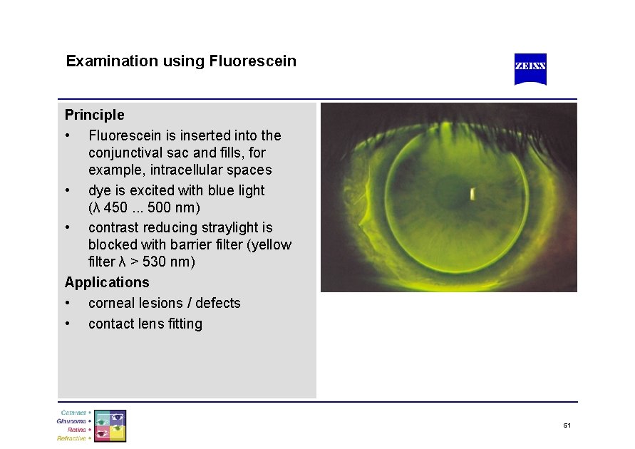 Examination using Fluorescein Principle • Fluorescein is inserted into the conjunctival sac and fills,