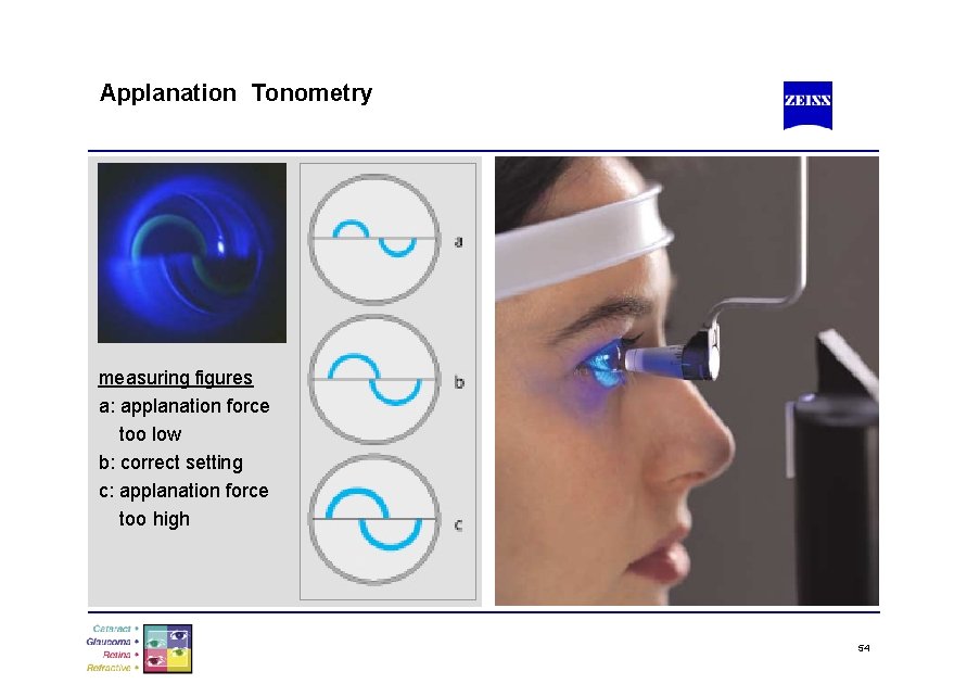 Applanation Tonometry measuring figures a: applanation force too low b: correct setting c: applanation