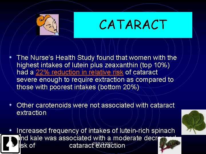 CATARACT • The Nurse’s Health Study found that women with the highest intakes of
