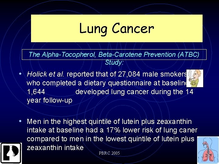 Lung Cancer The Alpha-Tocopherol, Beta-Carotene Prevention (ATBC) Study: • Holick et al. reported that
