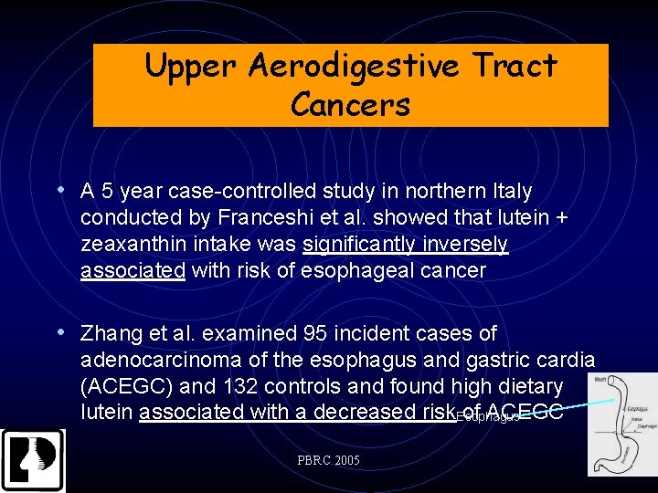 Upper Aerodigestive Tract Cancers • A 5 year case-controlled study in northern Italy conducted