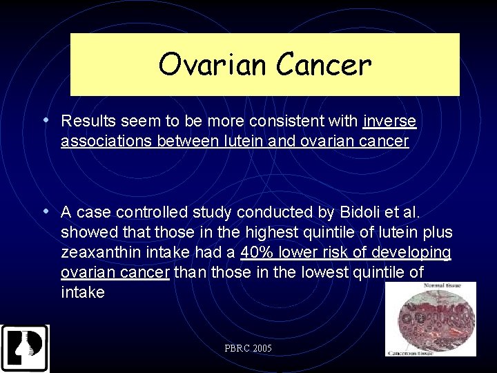 Ovarian Cancer • Results seem to be more consistent with inverse associations between lutein