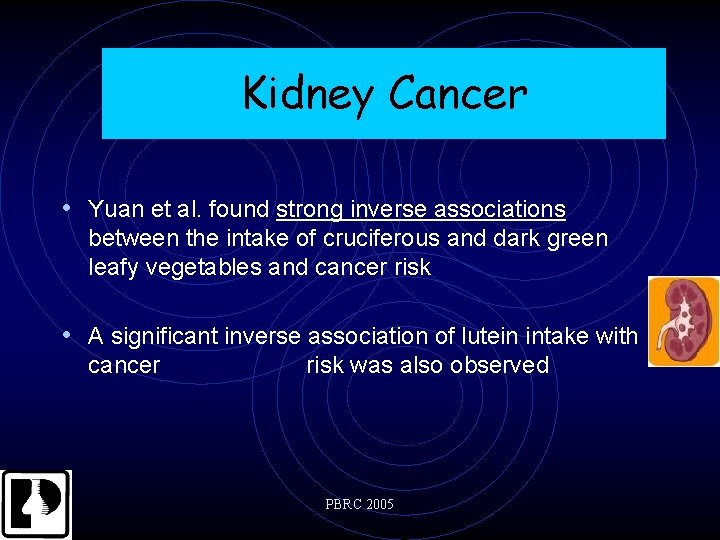 Kidney Cancer • Yuan et al. found strong inverse associations between the intake of